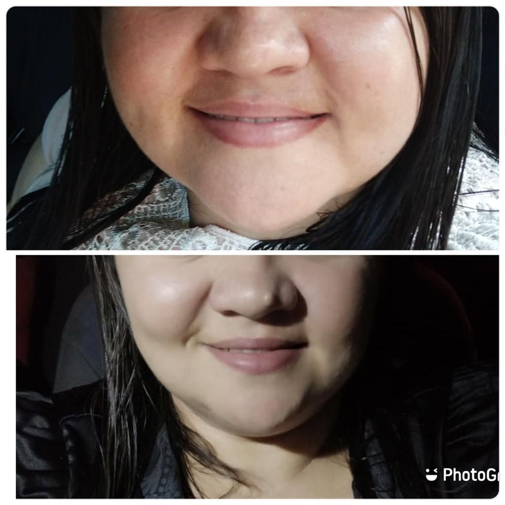 Antes e depois 4